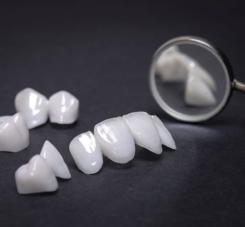 Up-close view of dental veneers